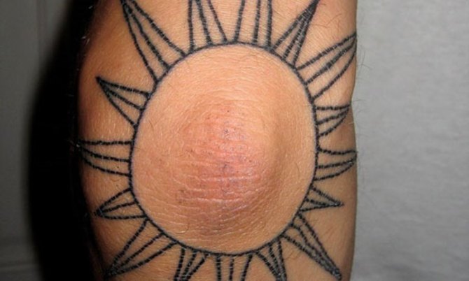 Elbow Sun Tattoo 